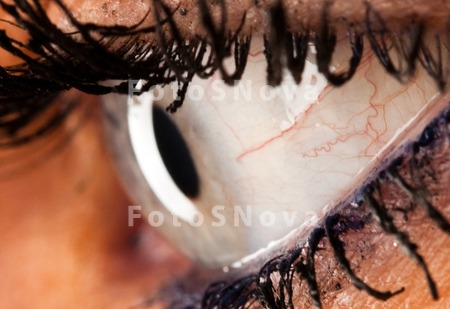 eye_capillary_close_up_macro_h